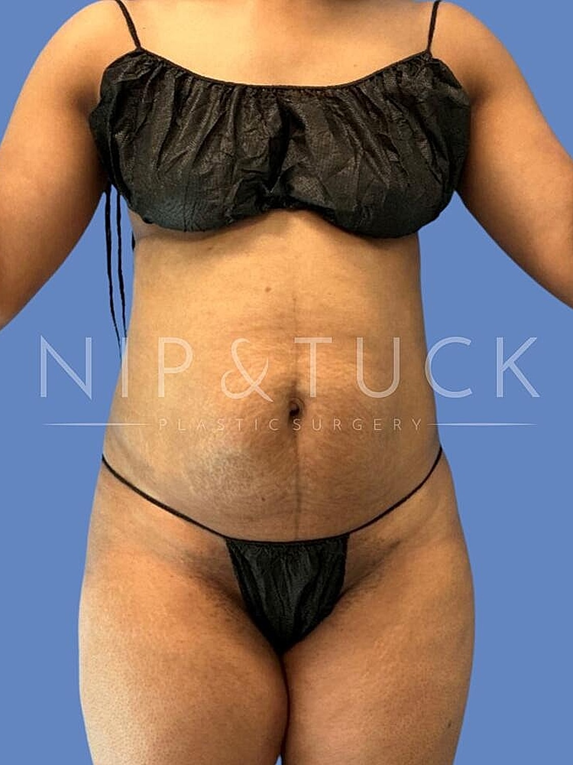 Model posing in swimwear, showcasing body confidence.