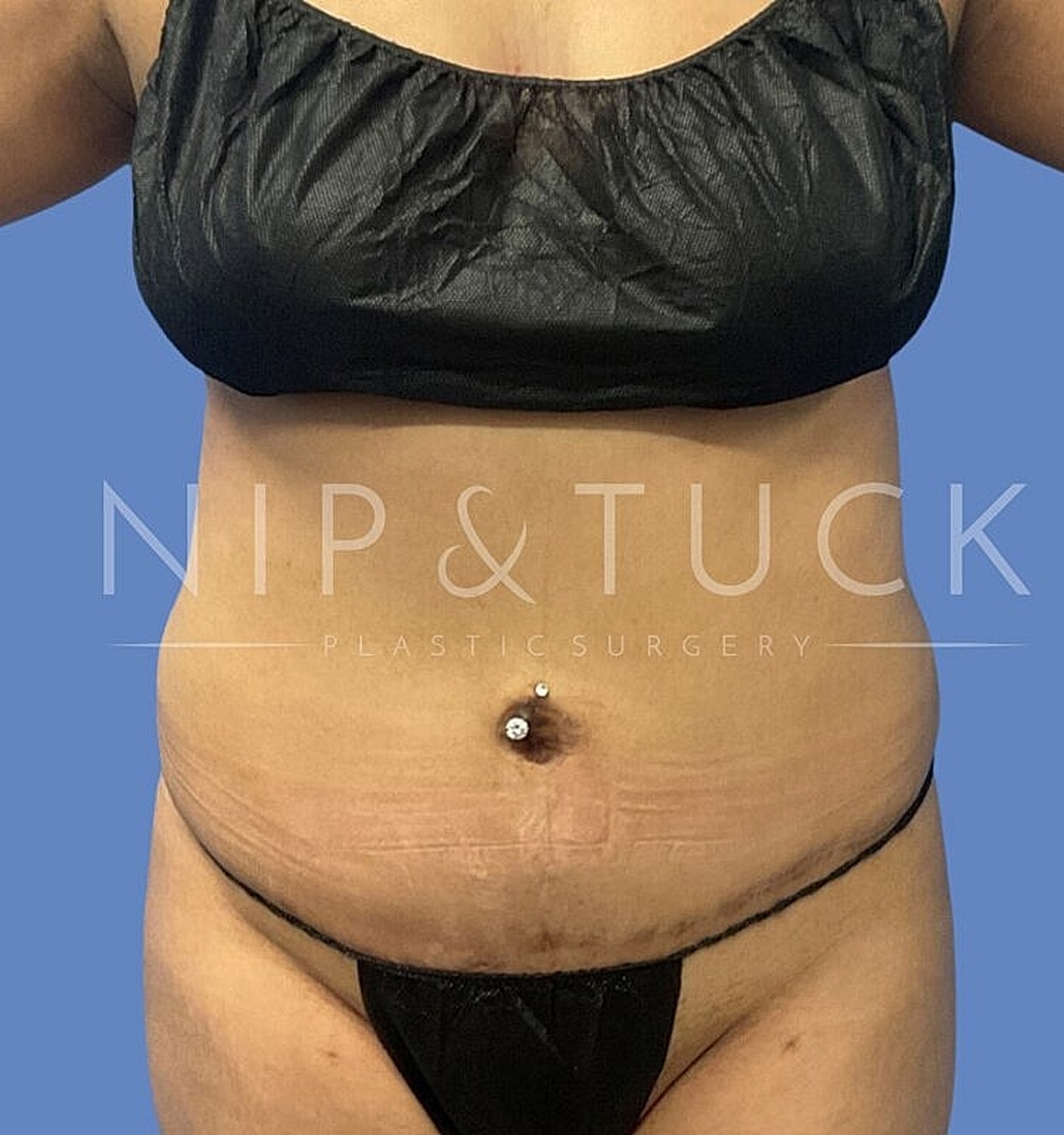 Plastic surgery consultation before photo session