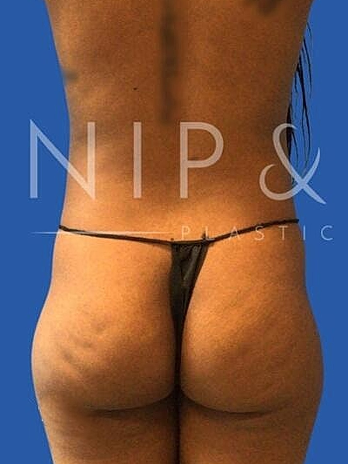 Back view of model in black thong.