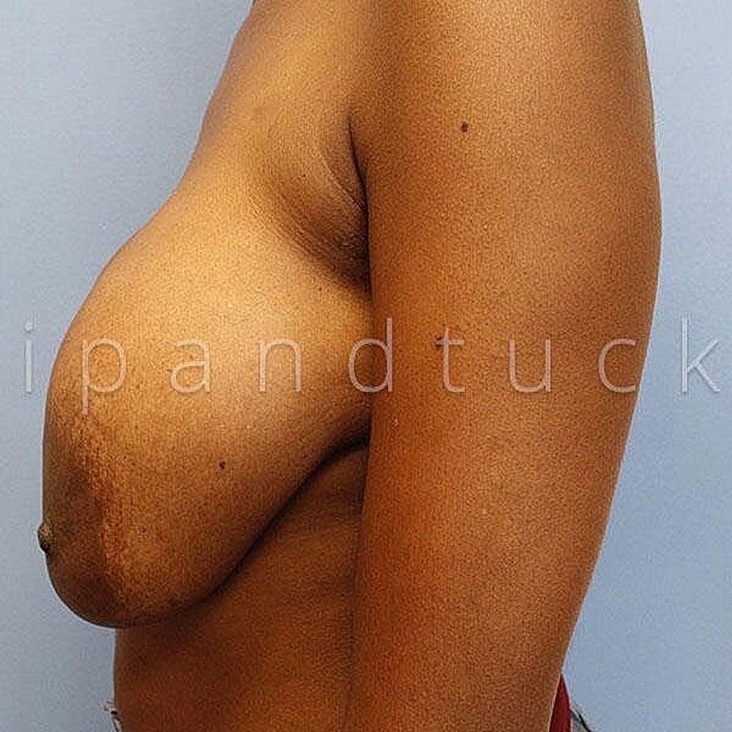 Profile view of female torso and arm.