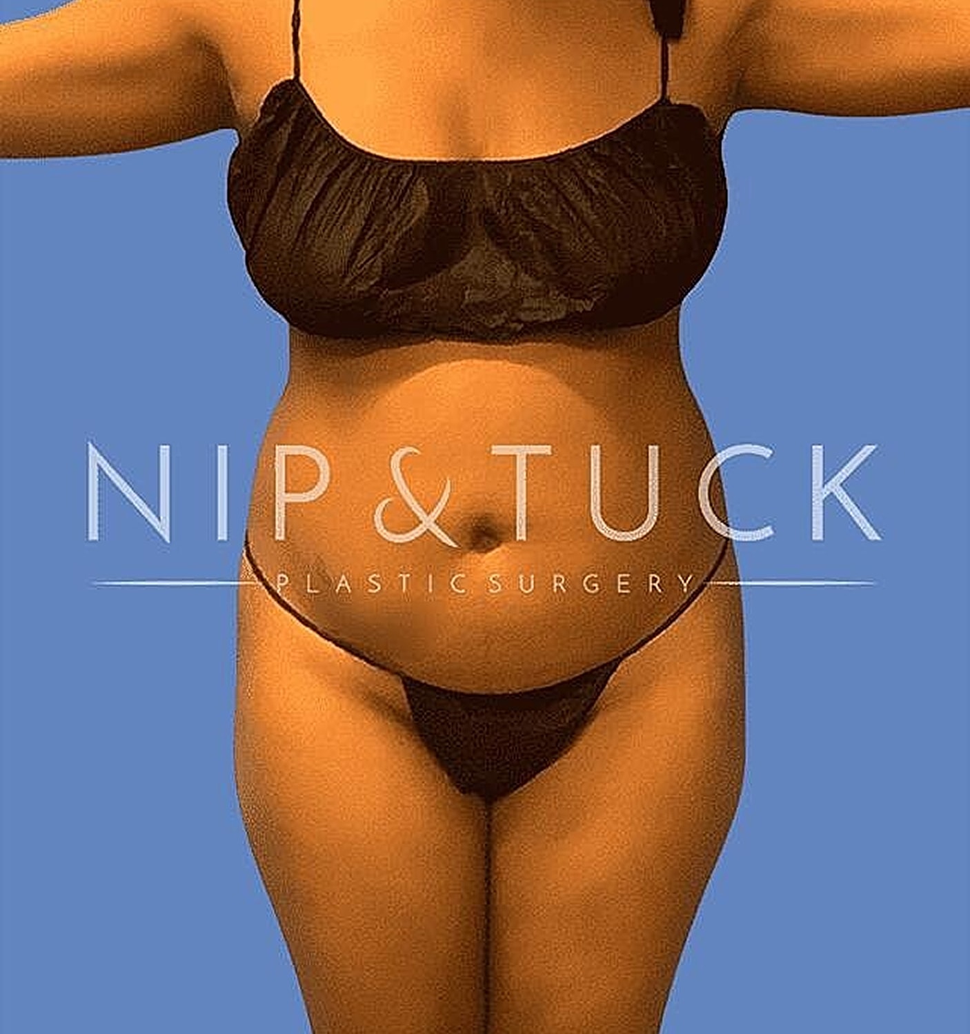 Liposuction Before & After