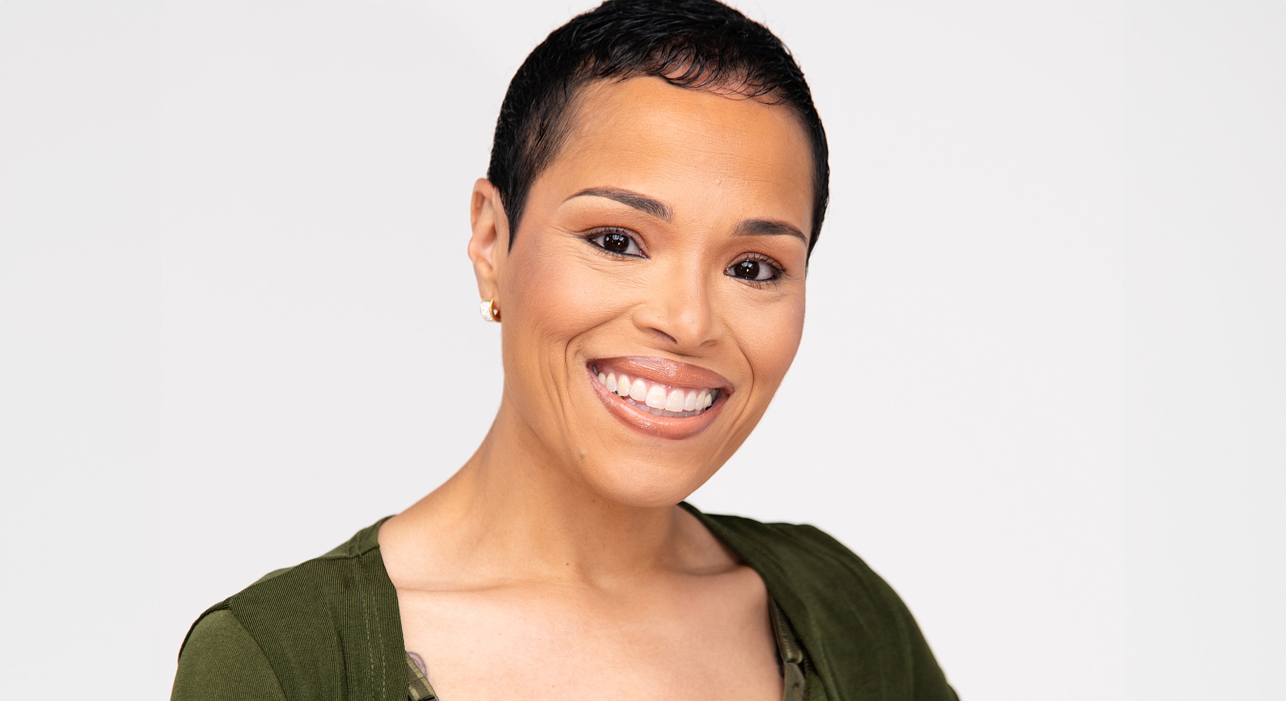 Atlanta Brow Lift model