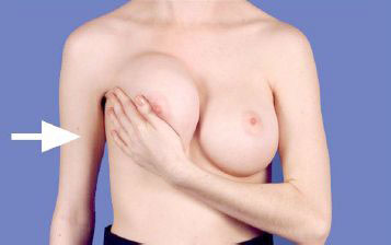 Breast Exercise