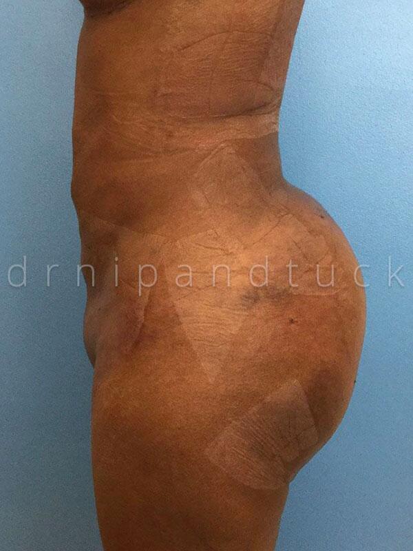 Patient #18 photos