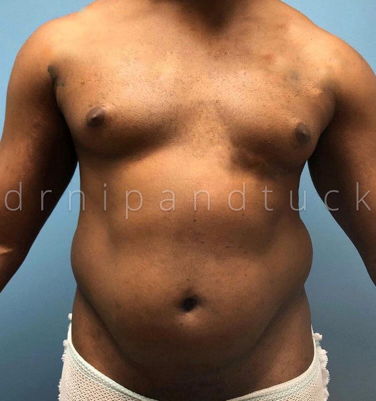 Patient #32 photos