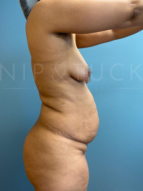 Patient #35 photos