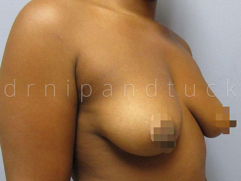 Patient #22 photos