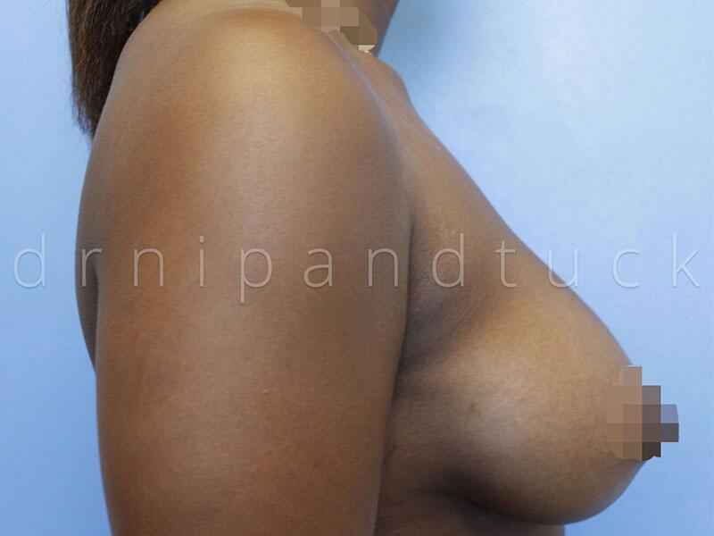 Patient #22 photos